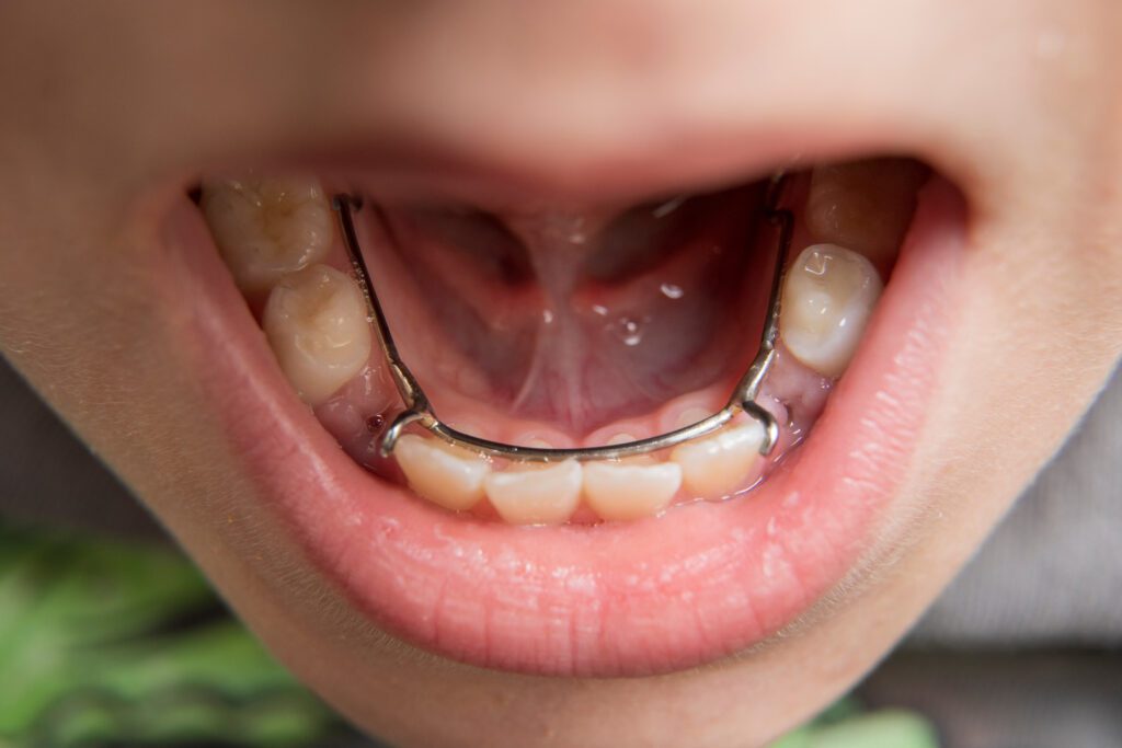 Precision Family Dental |