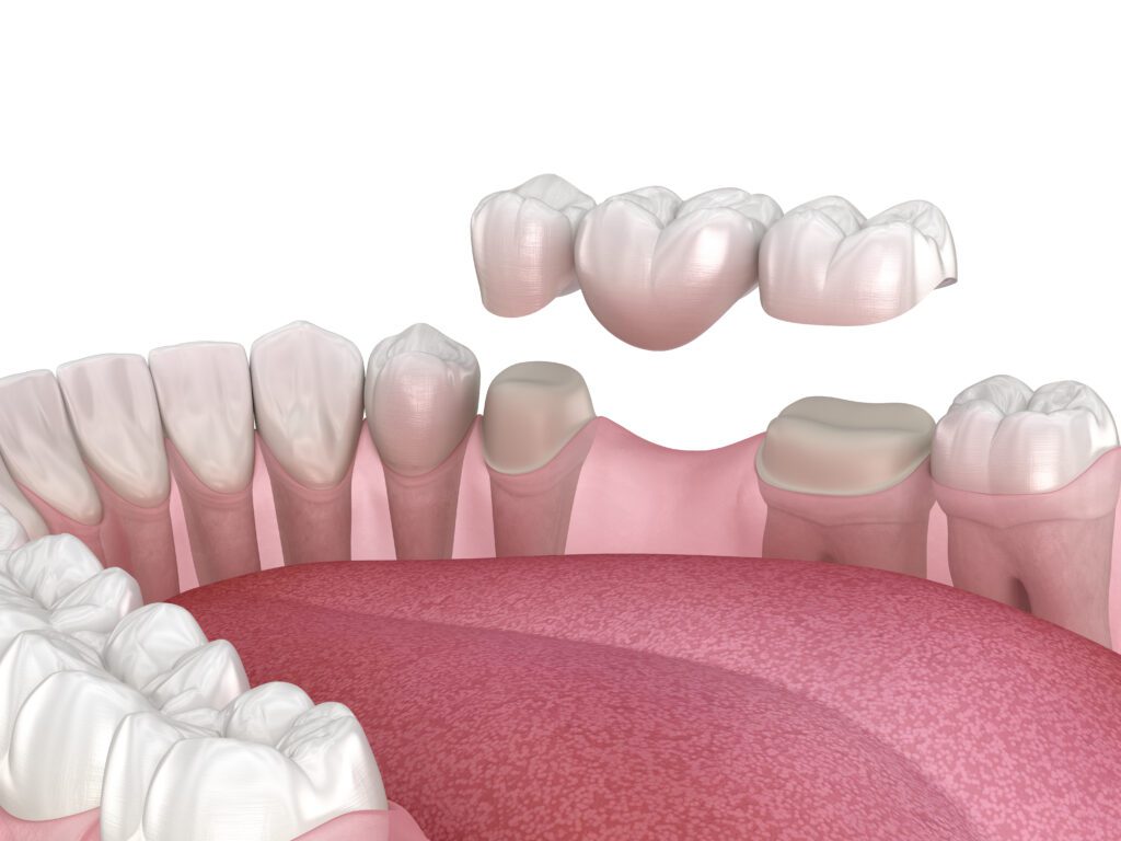 Precision Family Dental |