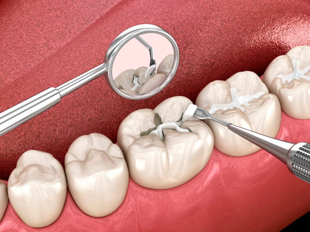 Precision Family Dental |
