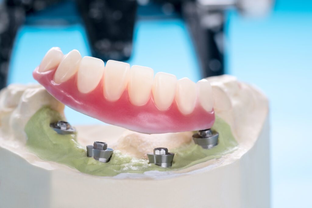 Precision Family Dental |